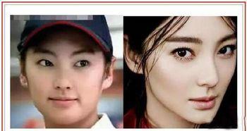 做双眼皮失败的明星,盘点那些术后失败的明星案例